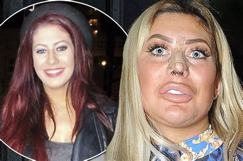 chloe ferry before plastic|chloe ferry fox eye.